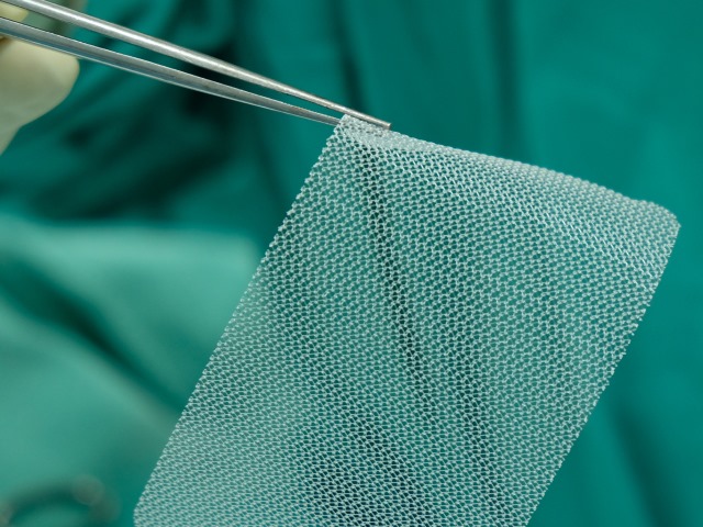 Hernia Mesh 640 x 480 April 2018